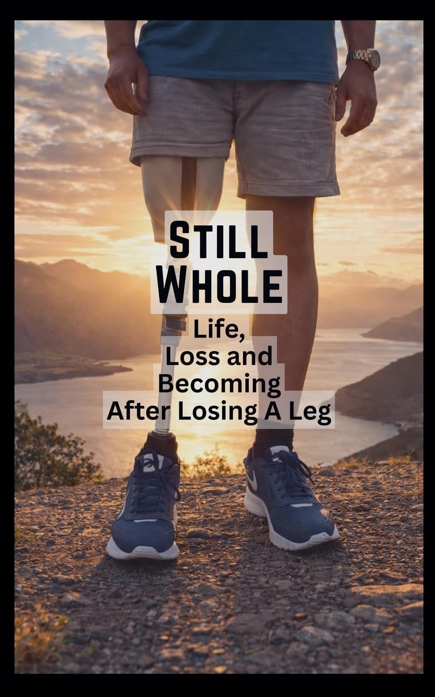 Still Whole: Life, Loss and Becoming After Losing A Leg