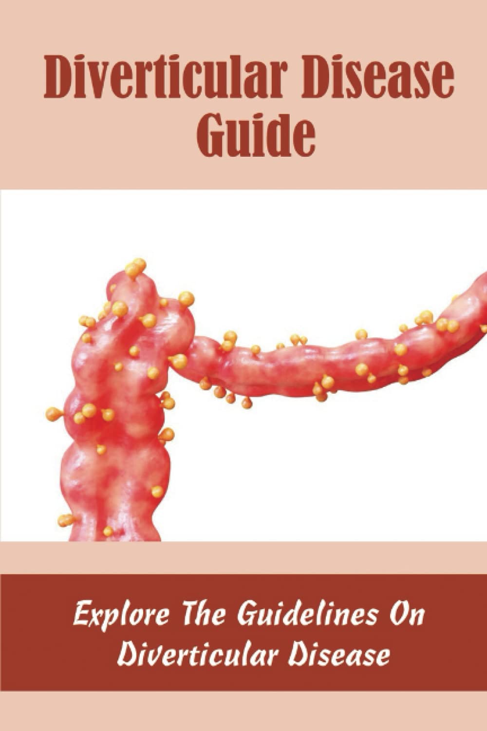 Diverticular Disease Guide: Explore The Guidelines On Diverticular Disease
