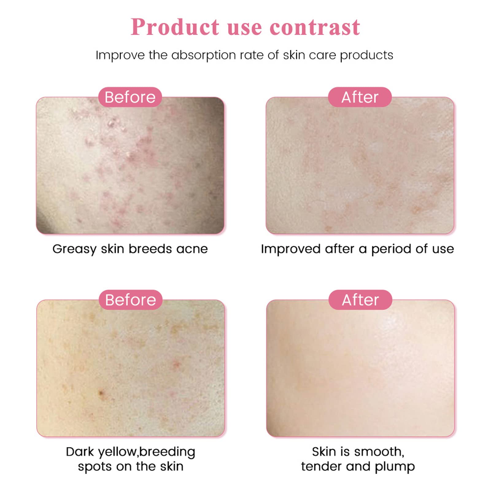 Penna Derma elettrica Dispositivo Senza Fili per la Cura della Pelle Dispositivo Professionale Microblading MicroAghi Pistola Cartuccia per mesoterapia Derma