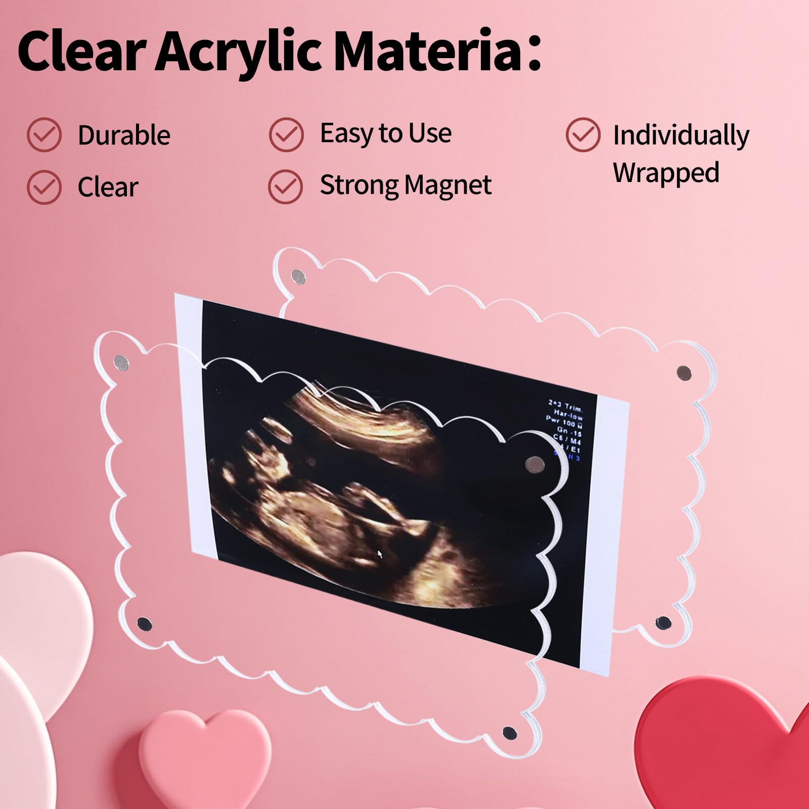 Mommy Frame Ultrasound Magnetic Acrylic Ultrasound Frame - Scalloped Edge  Display For Pregnancy Announcements Digital Ultrasound Picture Frame