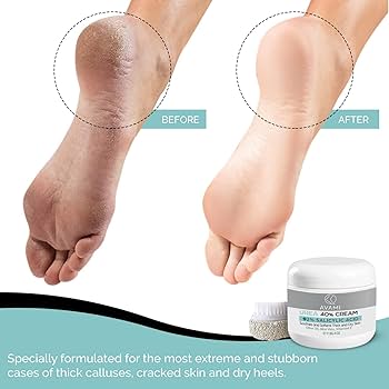 ✨象の足クリーム特別4個セット12月到着分とナイトA２本分のセット ✨象の足クリーム特別4個セット12月到着分とナイトA2