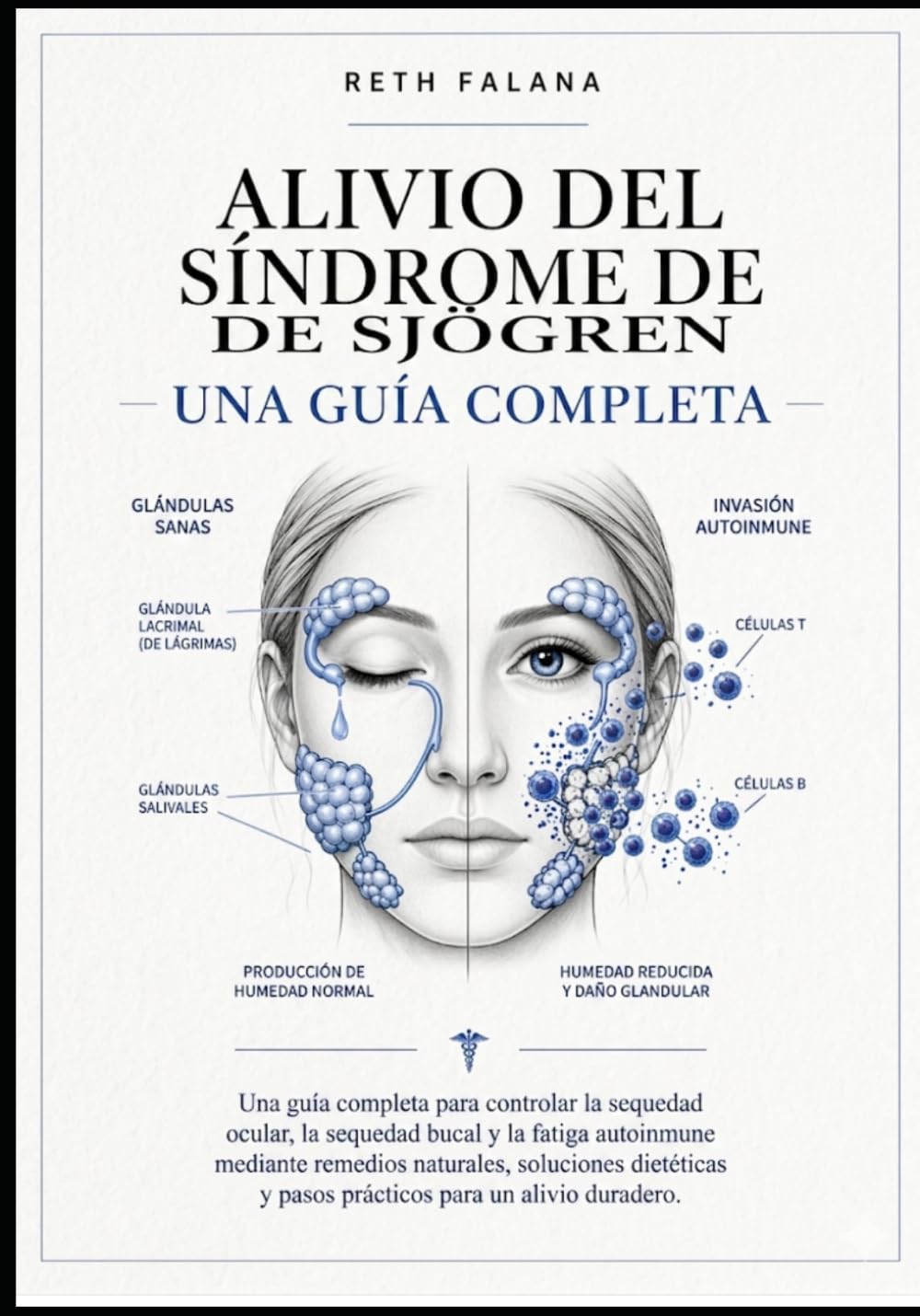 Alivio del síndrome de Sjögren: Guía completa para controlar la sequedad ocular, bucal y la fatiga autoinmune con remedios naturales, dieta y pasos prácticos.