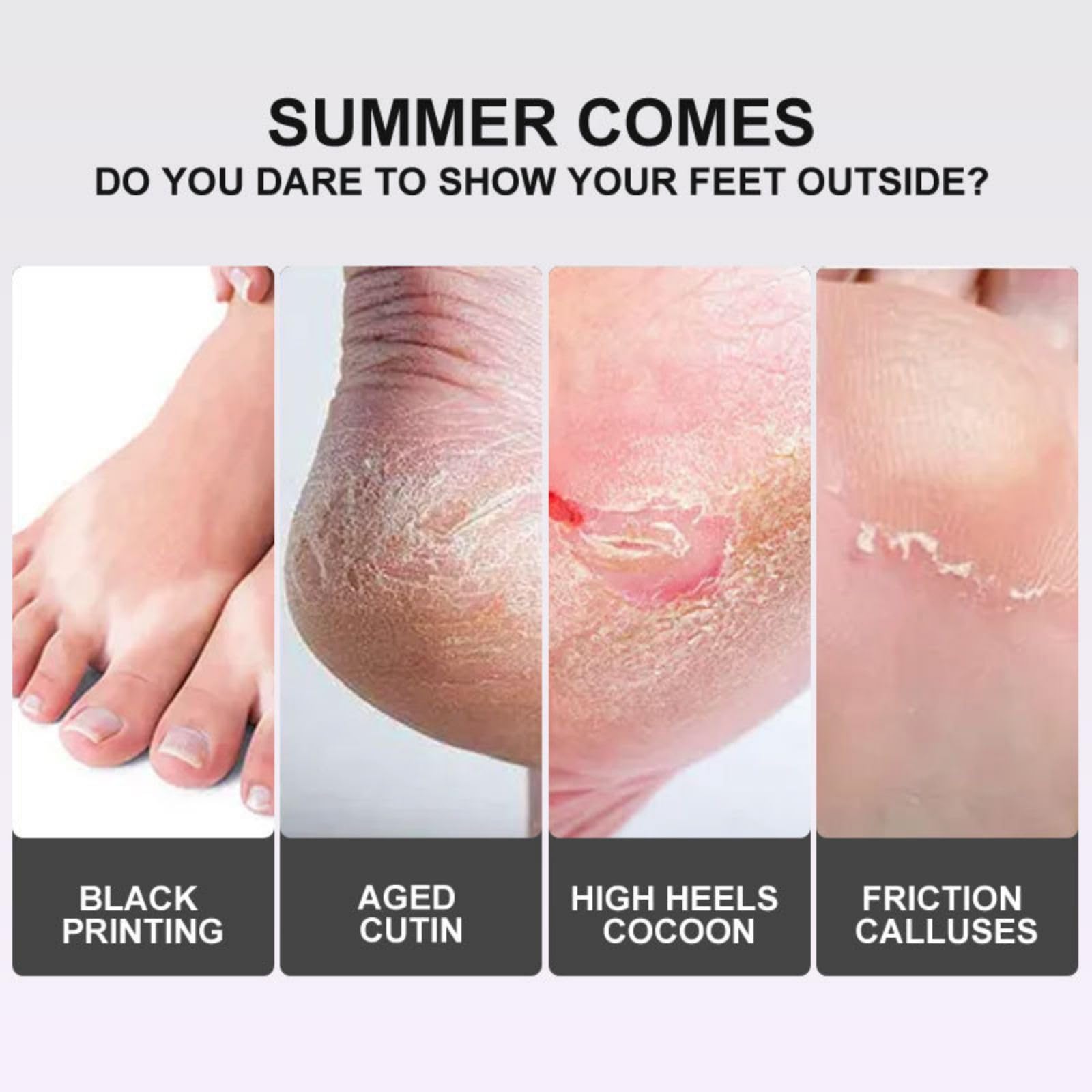 Joyeee Maschera Piedi Esfoliante, Lavender Foot Peel Mask, Efficace Peeling Piedi, Scrub Piedi e rimozione Calli dei Piedi, per Uomini e Donne, 5 paia