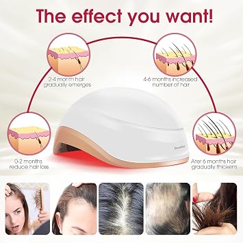 Laser Hair Growth Helmet, Laser Red Light Therapy for Hair Growth, Laser Cap for Hair Regrowth Stimulate Denser Fuller Hair,256 Laser Diodes