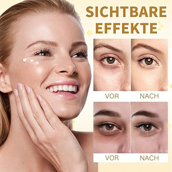 Collagen Eye Cream - Eye Cream Against Wrinkles and Dark Circles - Remove Dark Circles Eye Cream Against Bags - Nourishing & Anti-Ageing Eye Care - Eye Circles Cream