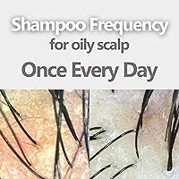 Vista 5 de Aromase Champú equilibrador de cuero cabelludo graso (ideal para cuero cabelludo graso con caspa) 14 onzas líquidas