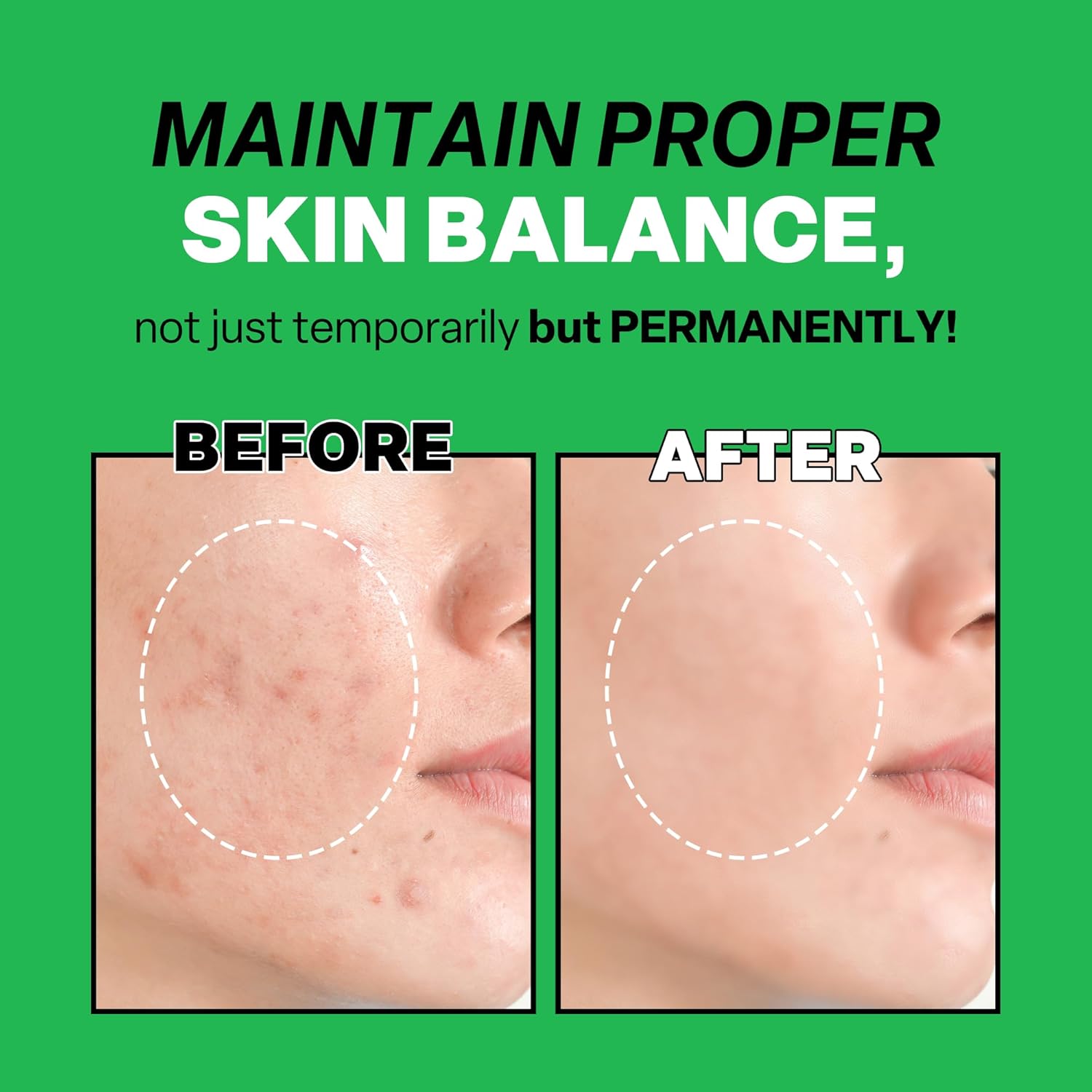 Troubless Mild Clear Toner Essence - Tea Tree Facial Toner for All Skin Types | Hydrating Skin Toner, Daily Skin Care (6.76 fl oz) - Image 5