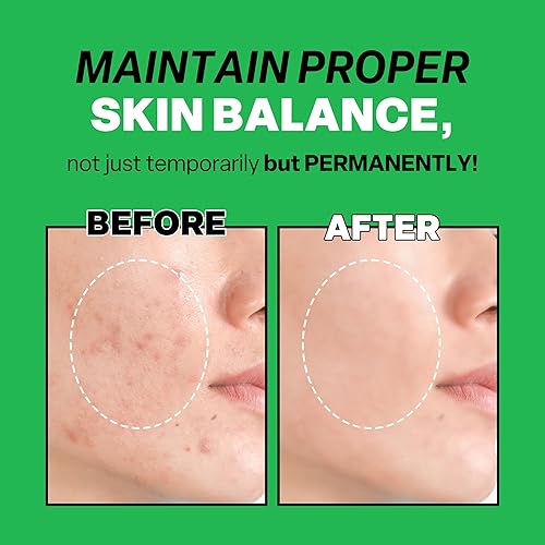 Miniatura 5 de Troubless Mild Clear Toner Essence - Tónico facial de árbol de té para todo tipo de piel, tónico hidratante para la piel, cuidado diario de la piel