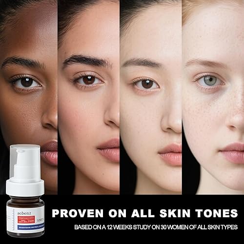 Miniatura 5 de SINPIN Aobenz - Removedor de manchas oscuras para rostro y cuerpo, suero corrector avanzado para la edad, melasma, sol, acné, manchas negras, ácido