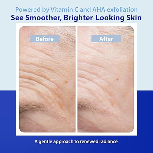 Miniatura 4 de DR. DENESE PEEL RX: VITAMIN C FACE PASTE & AHA PEEL DROPS SET | Una exfoliación física y química | Revela una piel radiante GlasSLIKE brillante |