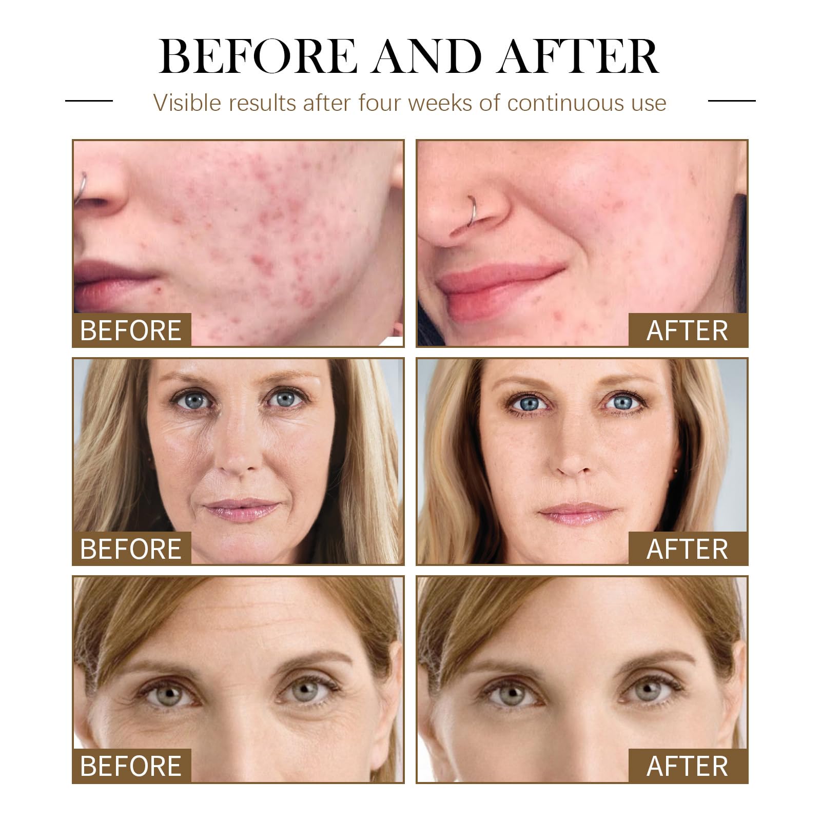 Face Oil, Oil for the Face Rosehip Oil Face Serum, Moisturising and Nourishing Face Oil, Everyday Oil, Body Oil for Skin Hydrate Serum - Image 2