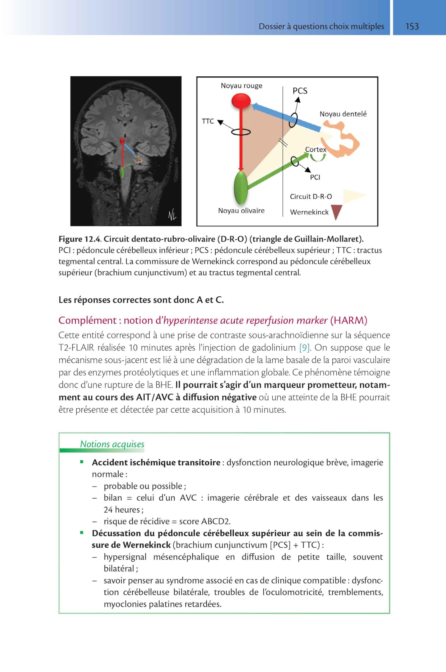 Imagerie de l'accident vasculaire cérébral ischémique aigu: Méthode d'auto-apprentissage