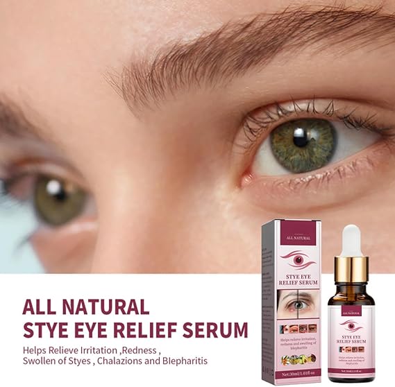 Stye Eye Treatment for Styes Chalazion&Blepharitis,Relieve Puffiness Serum