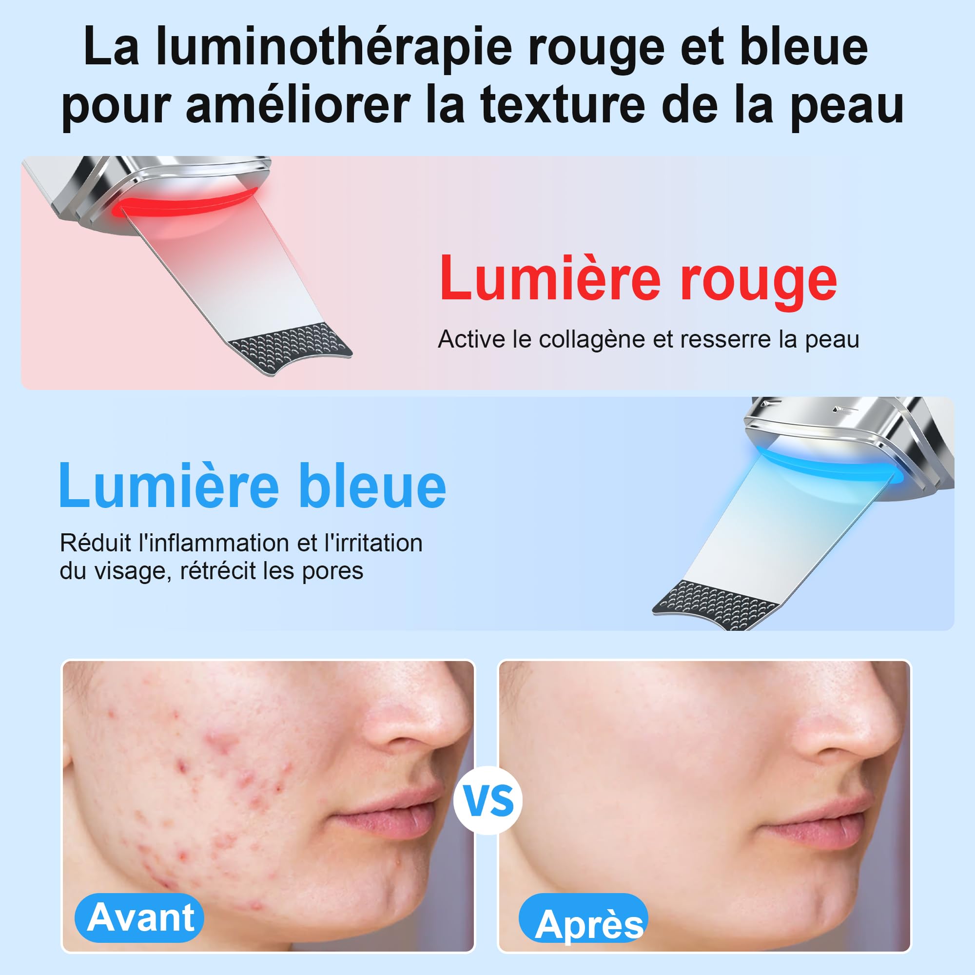 Épurateur de Peau à Ultrasons, Épurateur Visage Skin Scrubber avec 4 Modes et Intensité Réglable, Lumière Rouge et Bleue, Appareil de Nettoyage Exfoliant à Ultrasons