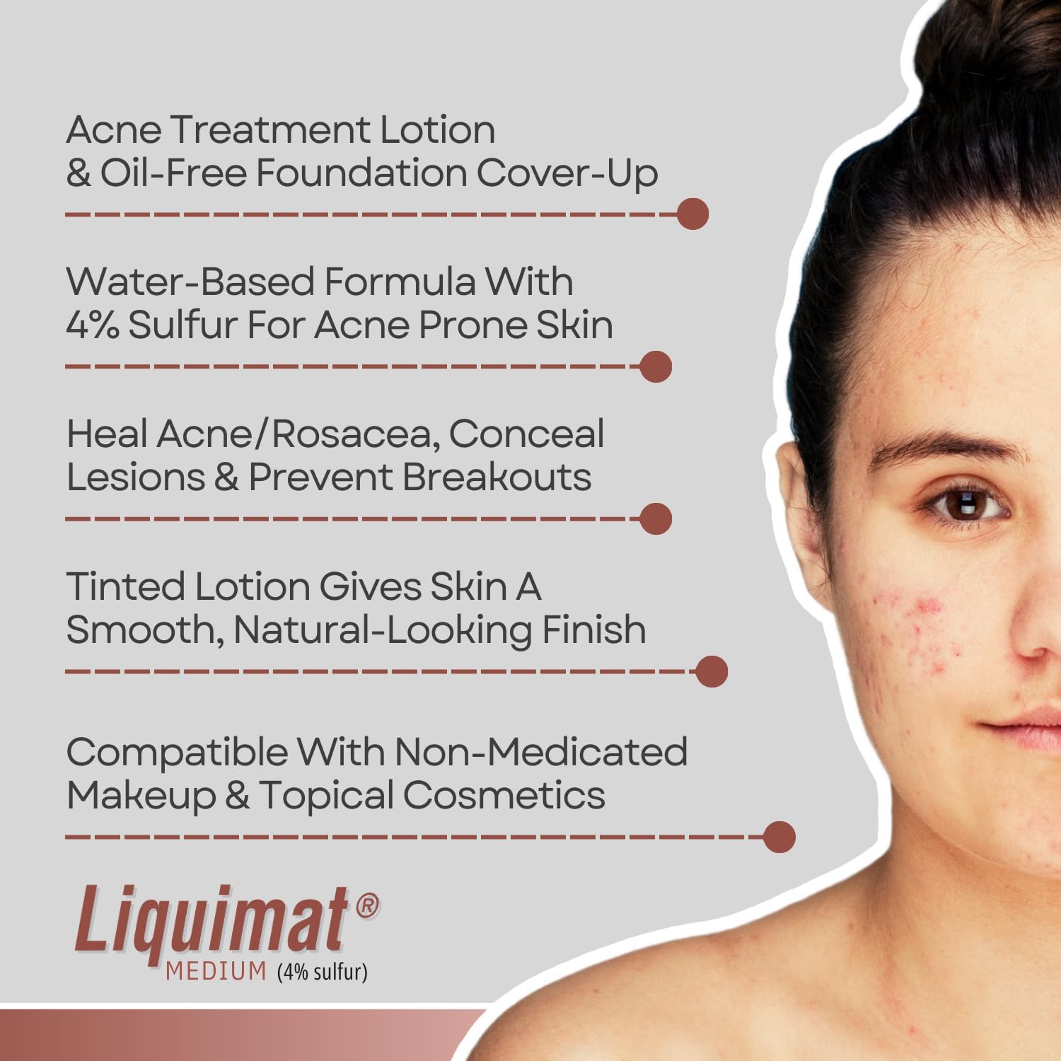 topical l carnitine for acne Amazon.com: Liquimat Acne Treatment and Cover-Up Lotion Medium 1.50 oz  (Pack of 2) : Health & Household