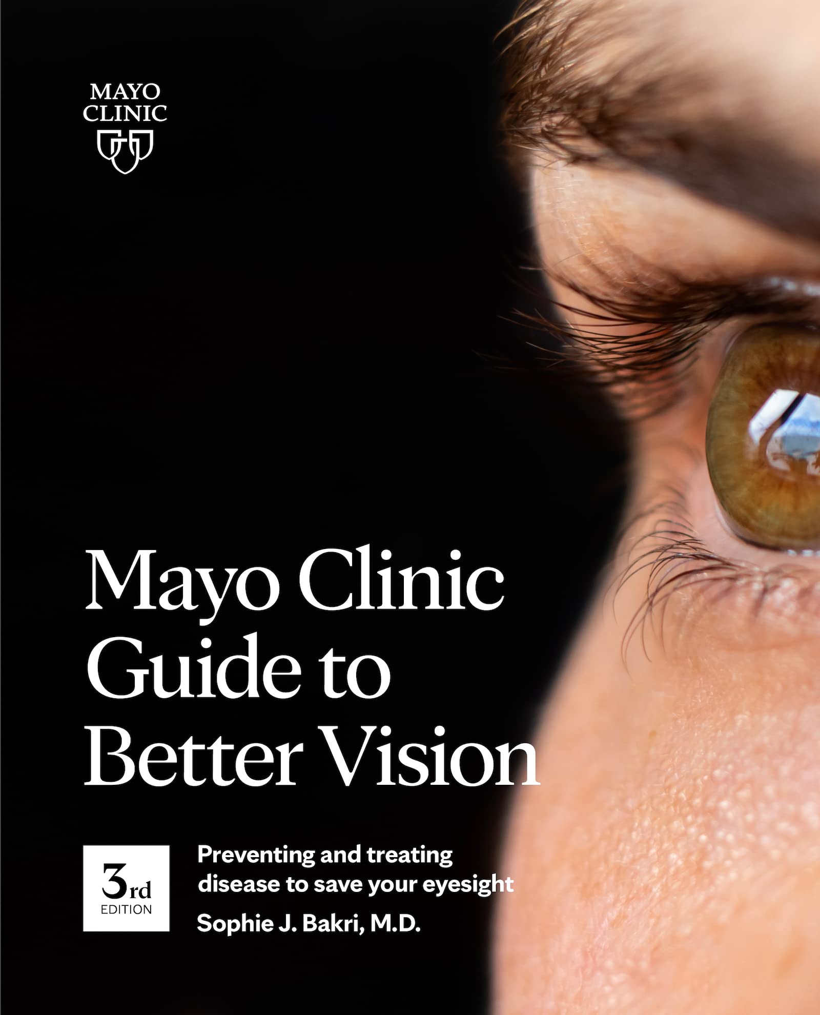 Mayo Clinic Guide To Better Vision, 3rd Ed: Preventing and treating disease to save your eyesight