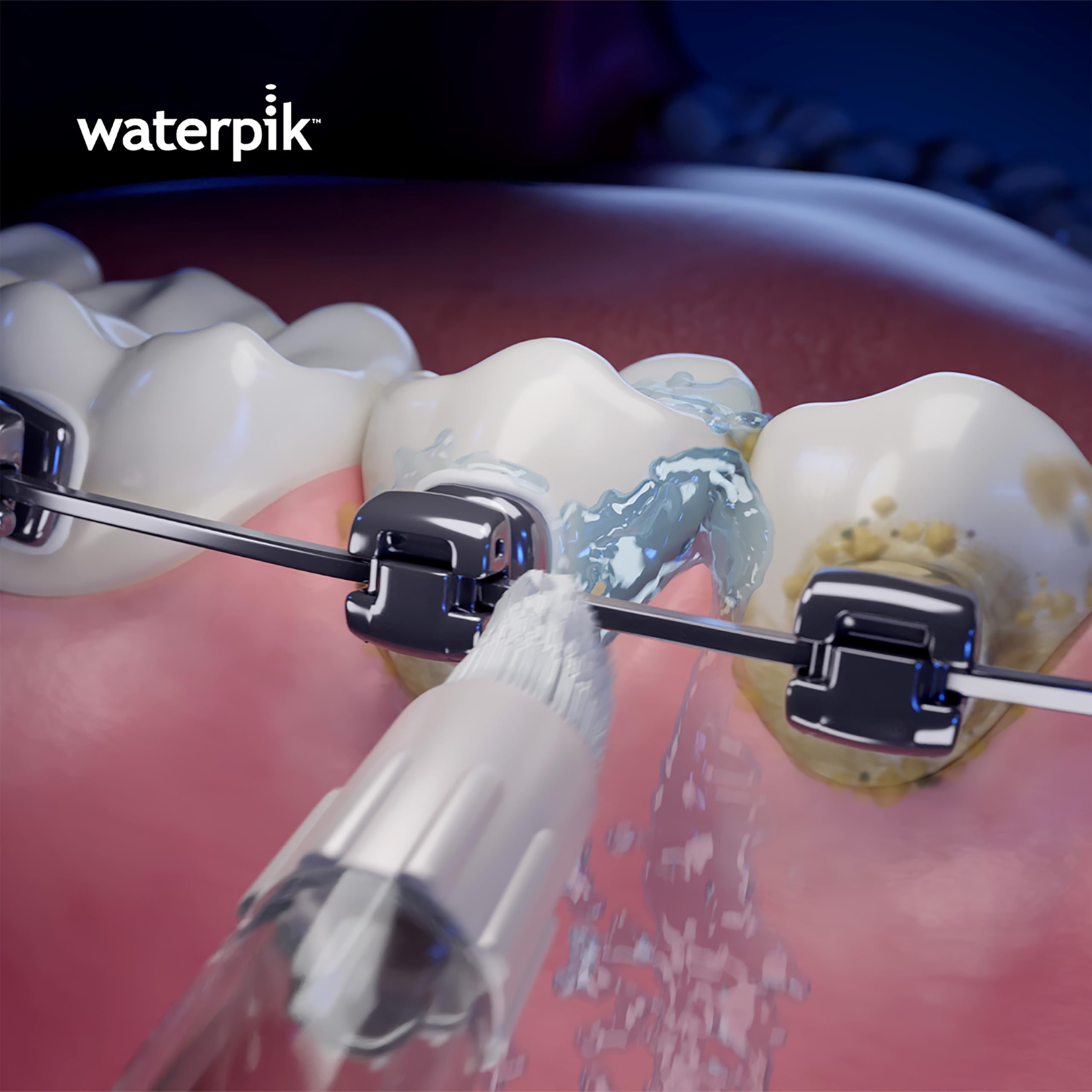 Waterpik Końcówki do Irygatora Orthodontic Tip, do Koron, Mostów, Implantów, Aparatów, Końcówki Zastępcze, do Modeli WF-05 i WF-06, 2 Sztuki (WOD-2E)