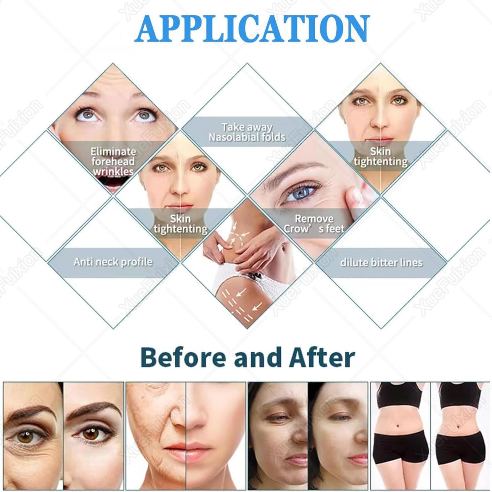 Dermapen Radiofrecuencia Lujo - Dispositivo Micro-Needling Profesional para Tratamiento Anti-Edad en Casa,Eliminación de Manchas Solares y Liftado No Quirúrgico