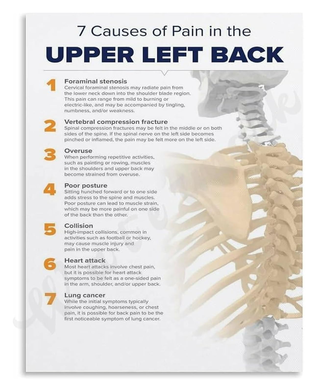NWPNLXEA 7 Upper Back Anatomy Landmarks Poster Scapula Rhomboids Traps Guide Educational Canvas Living Room Chiropractor Office Decor