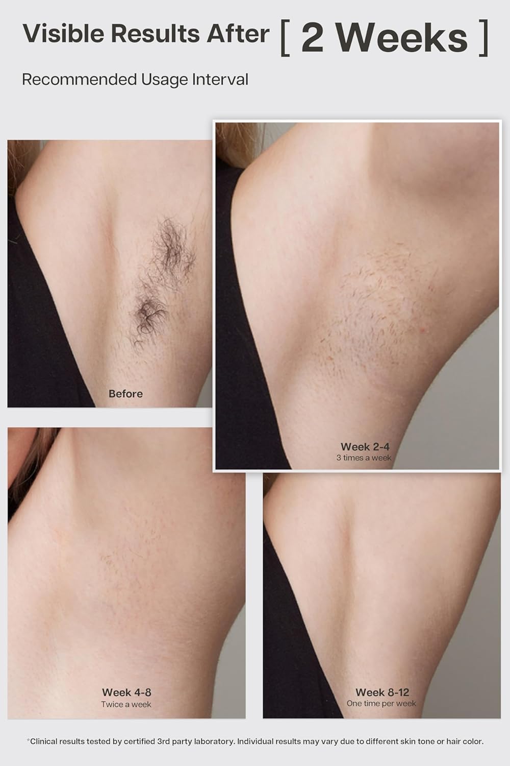 VRAIKO LYRA IPL Hair Removal Device, Laser Hair Removal for Women and Men, Sapphire Ice-Cooling Contact with Interchangeable Attachment Filters, More Skin-Friendly Long-Lasting & Painless Results - Image 3