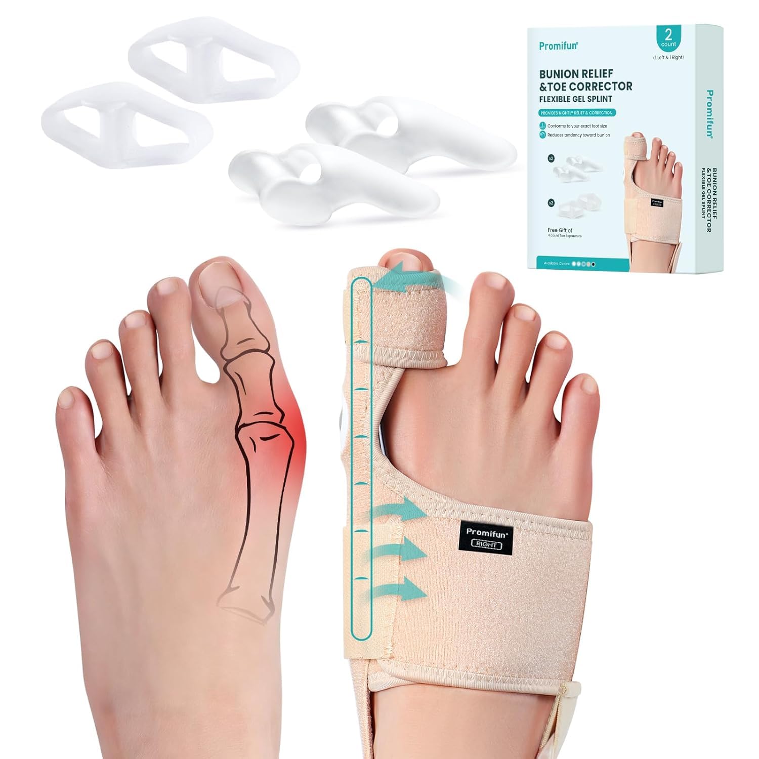Promifun Alluce Valgo Correttore, 1 paio di Tutore Alluce Valgo, Divaricatore Alluce Valgo, Separatore Divaricatore dita Piedi per Uomini e Donne, Sollievo dal Dolore (Beige)