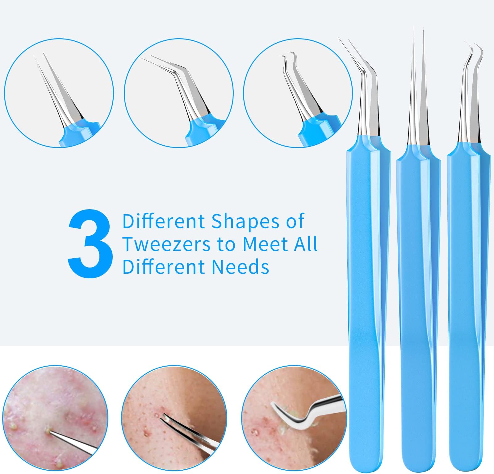 Blackhead Tool Kit, Blackhead Remover Comedone Acne Extractor Tools, Skin Care Tool, Professional Sharp Stainless Skin Blemish Removal Pimple Tools with Metal Case