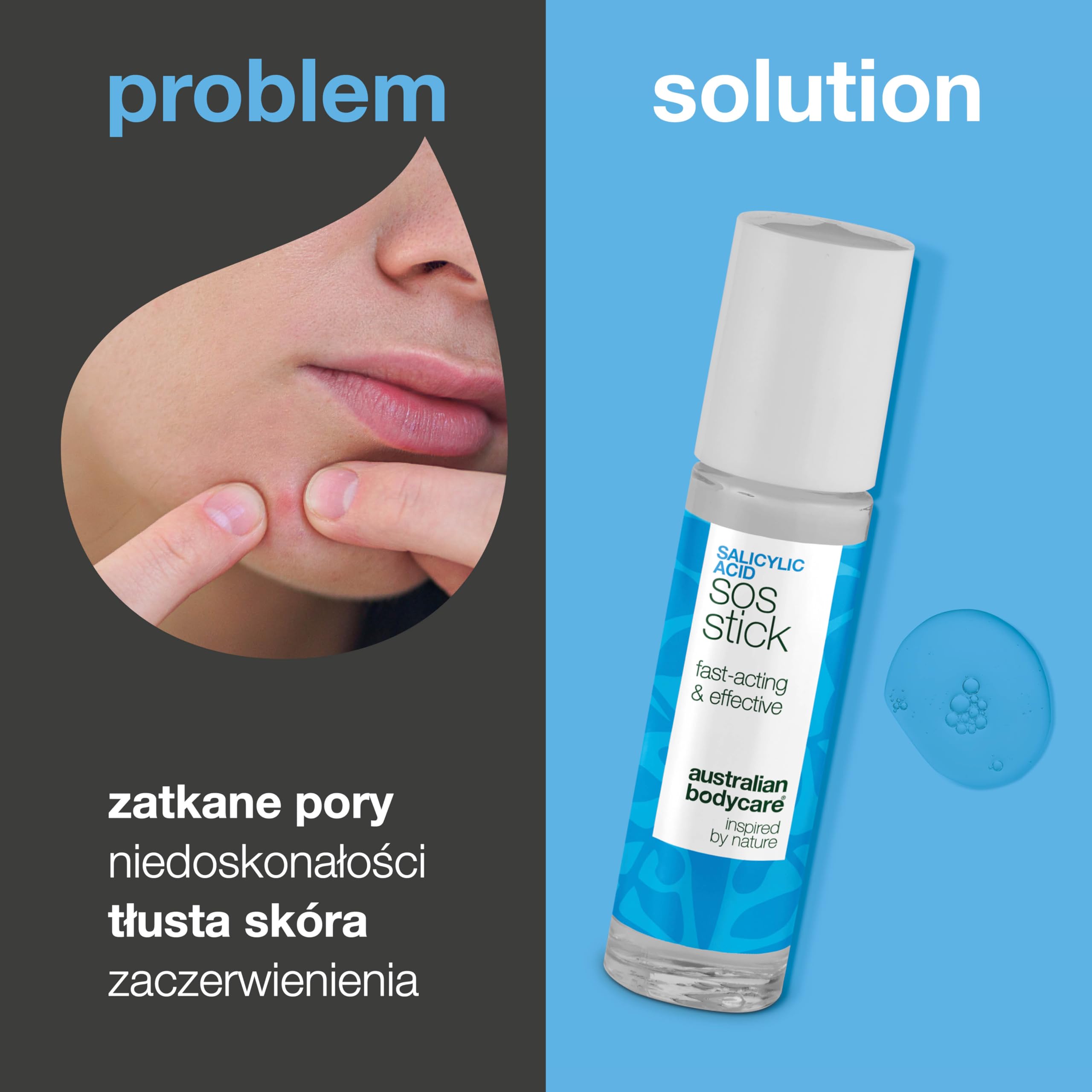 Sztyft SOS z Kwasem Salicylowym na wypryski, zaczerwienienia i zaskórniki – szybkie działanie dla czystej skóry z Salicylic acid