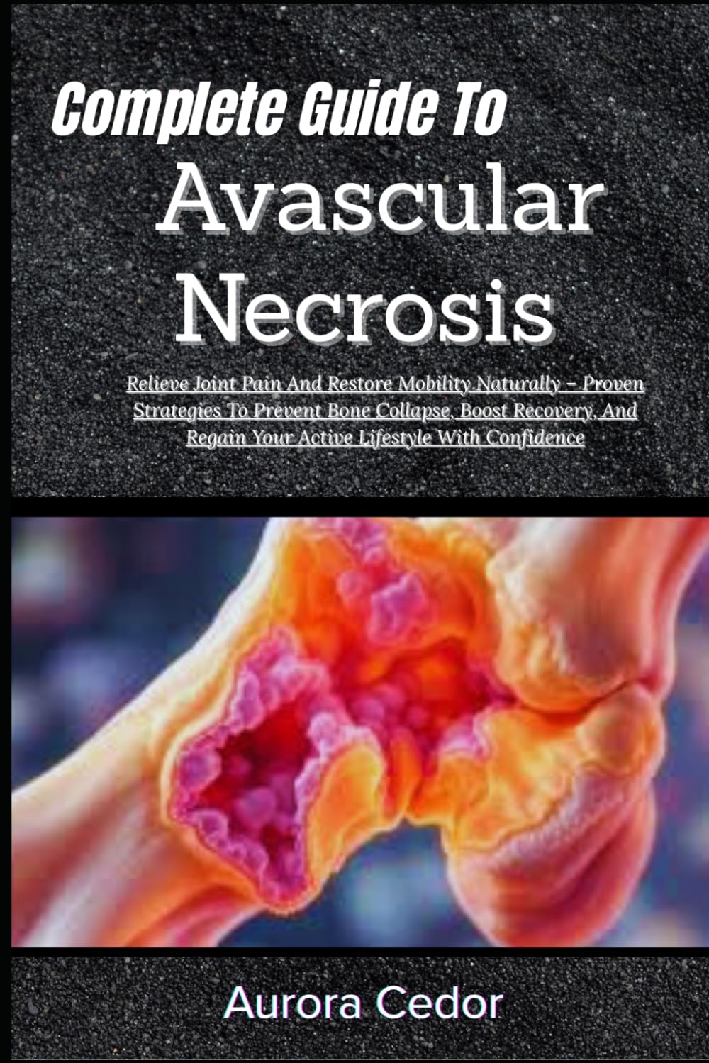 Complete Guide To Avascular Necrosis: Relieve Joint Pain And Restore Mobility Naturally – Proven Strategies To Prevent Bone Collapse, Boost Recovery, And Regain Your Active Lifestyle With Confidence