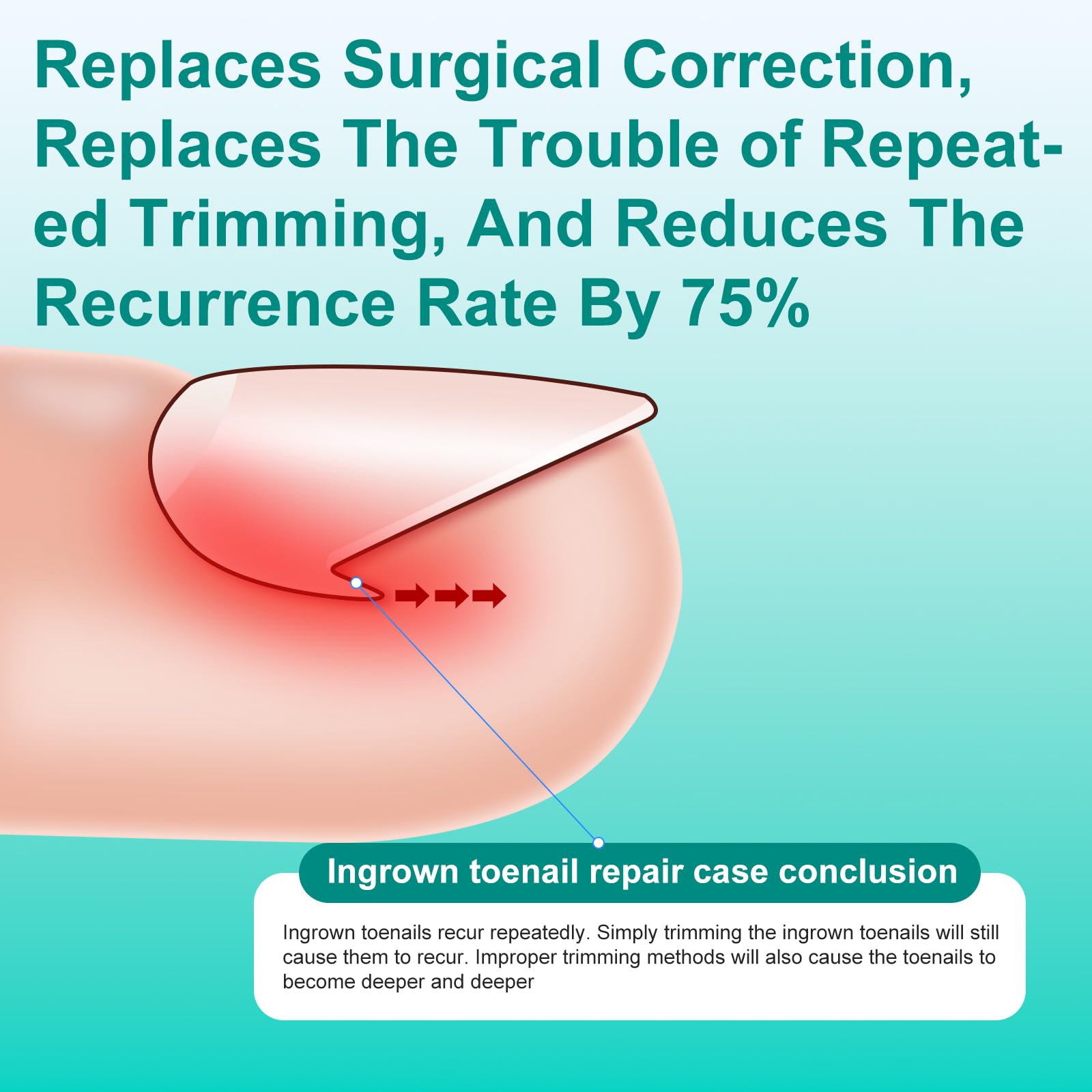 5 PCS Titanium Alloy Ingrown Toenail Treatment, Ingrown Toenail Removal Kit, Ingrown Toenail Corrector Specially Designed to Fix Crooked Nails and Correct Ingrown Nails