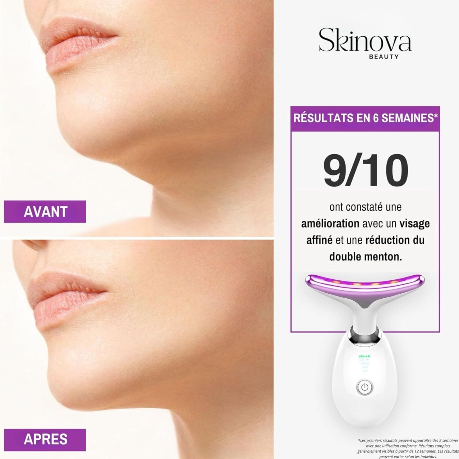 Skinova Beauty Lumi Beauty 7 Lumières Masseur Facial Anti-rides Avec Lifting, Nettoyage Et Lumière LED 7 Couleurs, Appareil Anti Rides Visage (Noir)