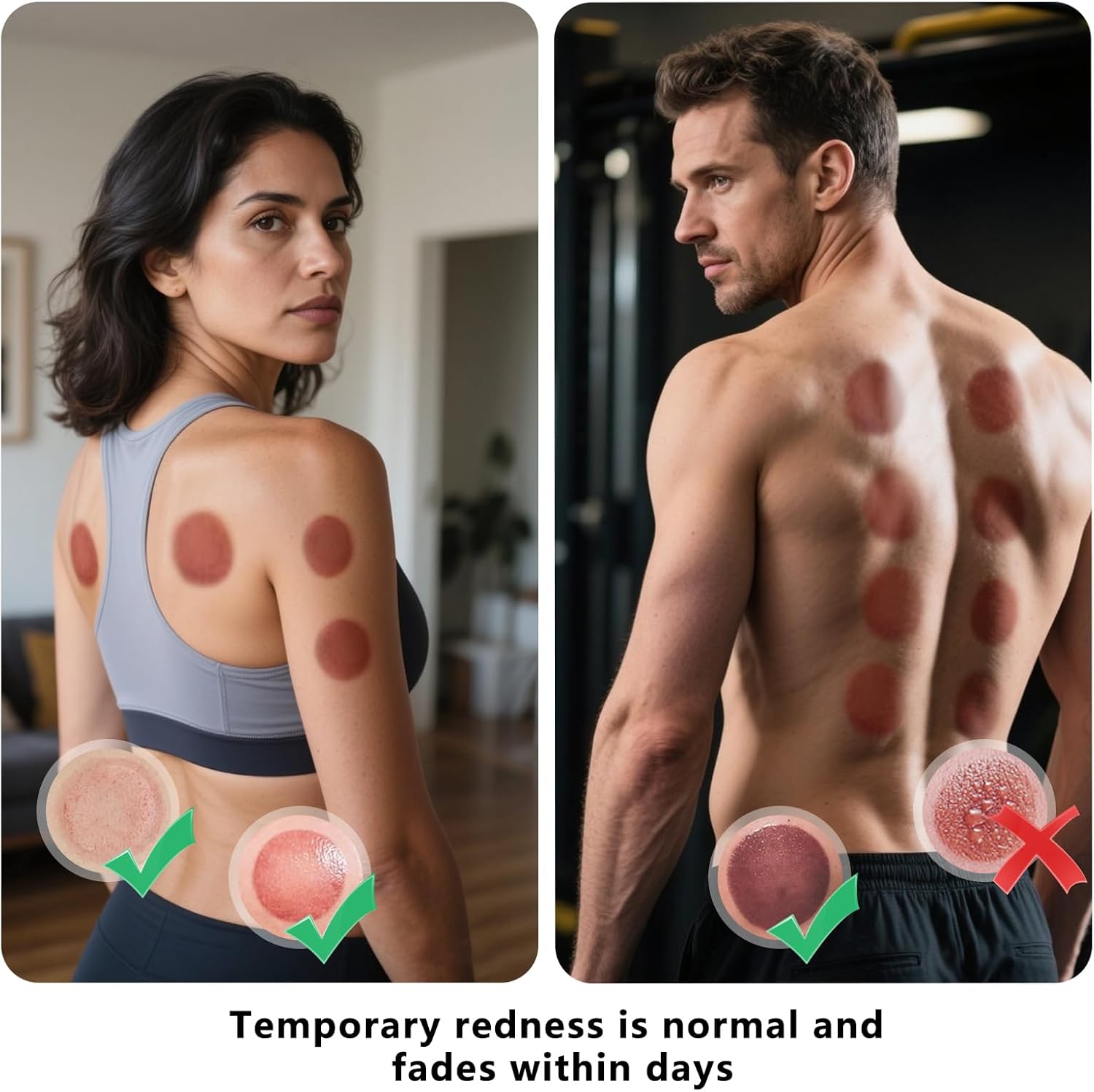 LIFELEC Smart Cupping Kit for Massage Therapy, 6-in-1 Red Light Cupping Therapy Set for Targeted Pain Relief, Knots, Muscle Soreness & Circulation, Portable Remote Control for Back Care at Home - Image 7