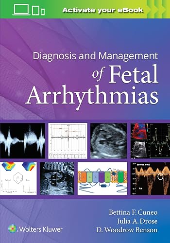 Diagnosis And Management Of Fetal Arrhythmias (Pb 2021)
