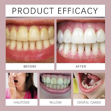 Fruit Oral Breath Spray,Pro-Biotic Oral Spray,Breath Freshener Spray,Oral Care Spray,Long-Lasting Mouth Freshener,Mouth Spray for Bad Breath,Breath Fresheners for Adults,Dry Mouth Spray,Mint