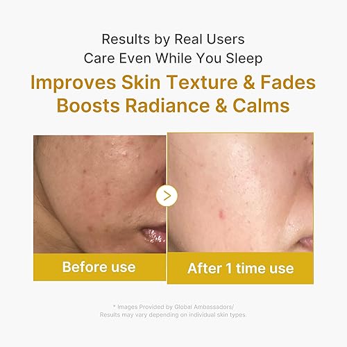 Miniatura 5 de medicube Máscara de envoltura de ácido kójico, cúrcuma, vitamina C durante la noche, máscara facial para despegar | Ilumina y defiende contra el