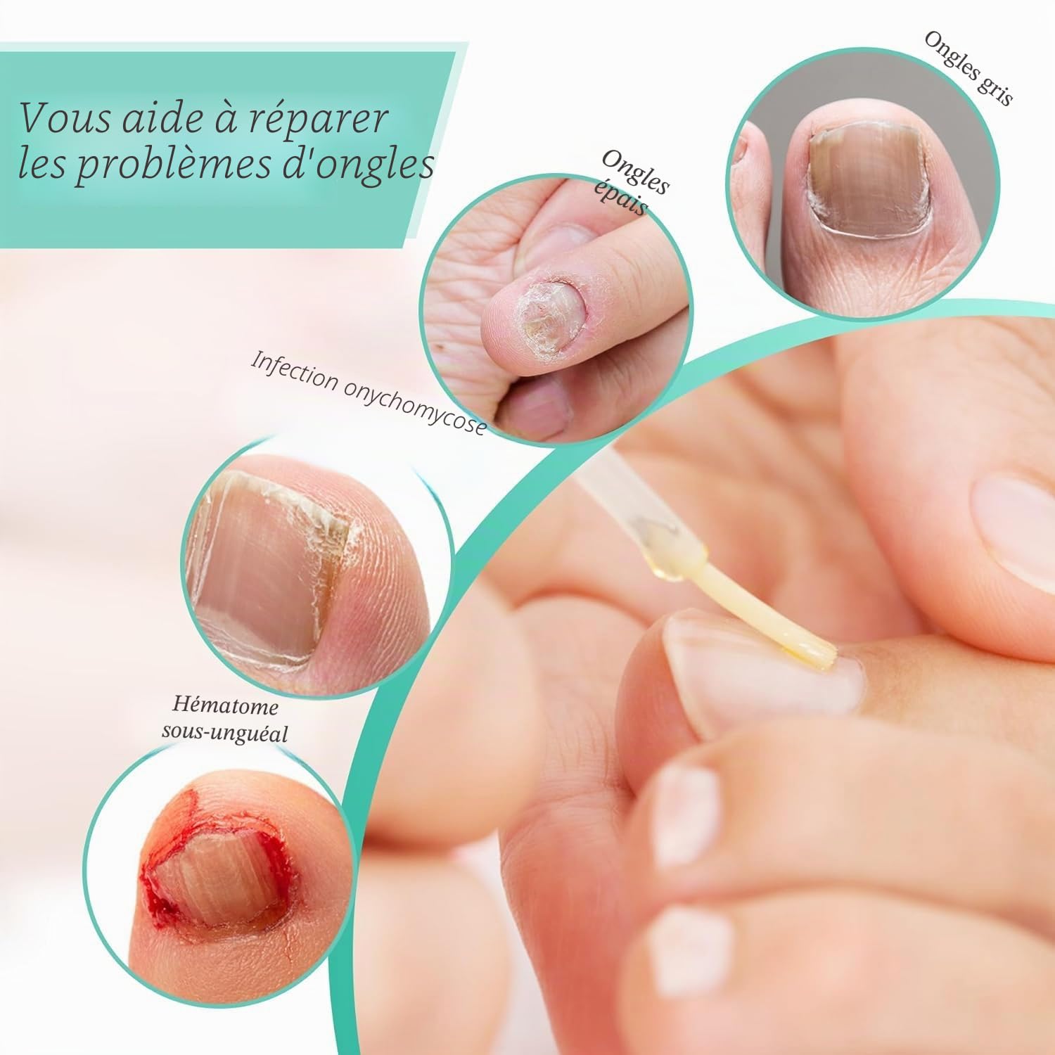 Nail Care Lot de 3 stylos réparateurs d'ongles pour la réparation des ongles, essence de structure des ongles, protection et renforcement des ongles, soin et réparation des ongles et des cuticules