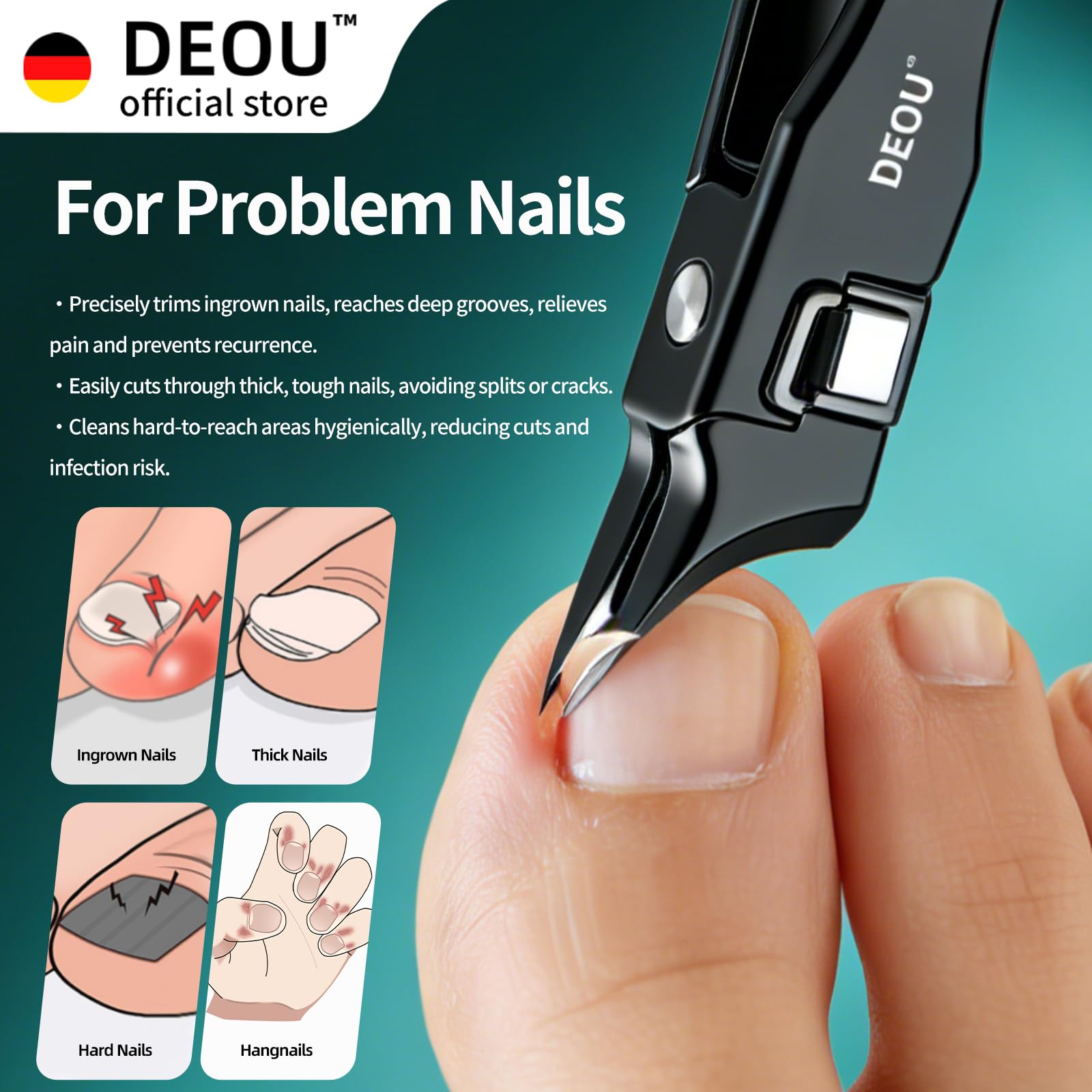 DEOU Tagliaunghie incarnite con lima per unghie, tagliaunghie obliquo in acciaio inox di alta qualità, anti-spruzzo, strumento per manicure con buco della serratura, confezione regalo per unghie