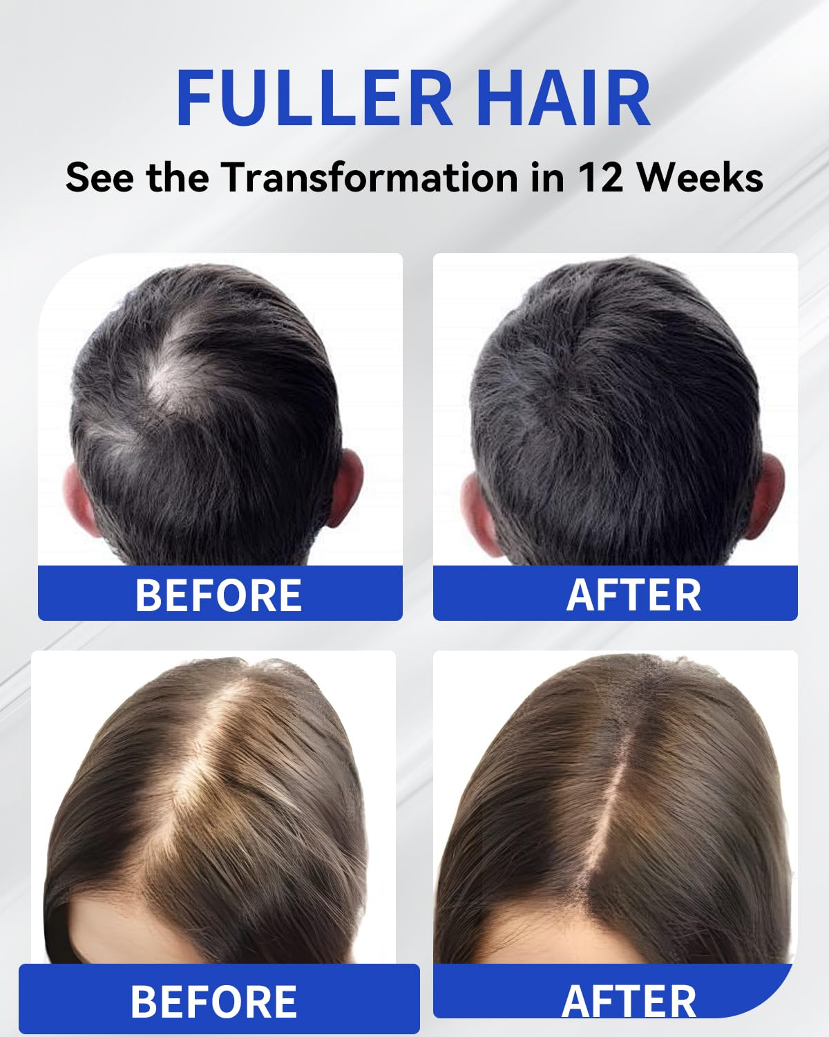 Hair Growth Serum Roll On 50ml | Hair Growth Serum 3% Rosemary Extract + Caffeine + Niacinamide + Biotin | With Ginger & Aloe Vera | No-Rinse, Fast-Absorbing | For Thinning Hair & All Hair Types - Image 3