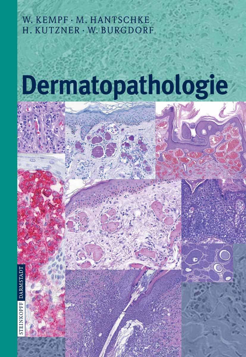 Dermatopathologie: Ein Einstieg