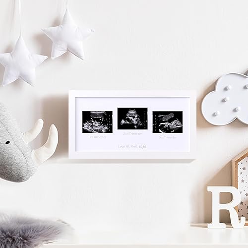 Miniatura 8 de eletecpro Marco de fotos de ultrasonido, para pantalla de fotos de ecografía de 3 x 4, marcos de fotos de sonograma para anuncio de embarazo,