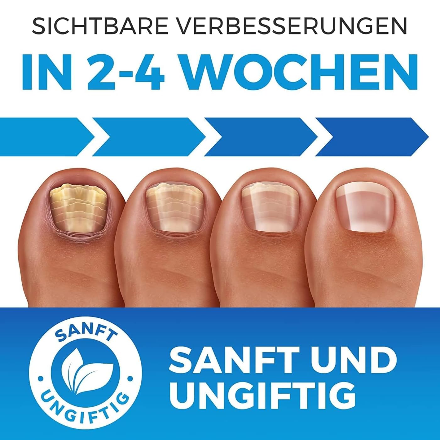 Imperial Feet Nagel Erneuerungsbehandlung - Schnelle Linderung bei beschädigten, gelben brüchigen Fußnägeln - Fortschrittliche Formel für verfärbte Nägel-Nagelreparatur – Feuchtigkeitsspendende
