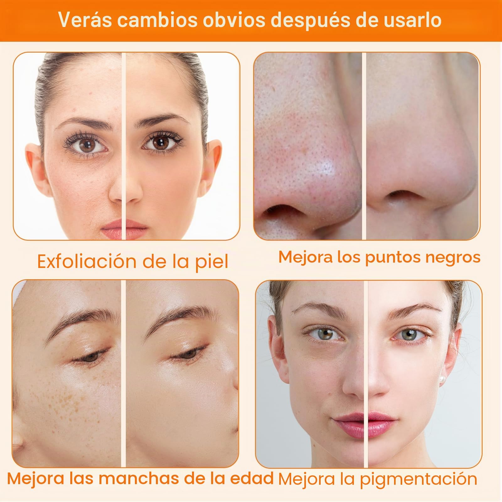 3 en 1 Dispositivo de Microdermoabrasión de Diamante, Dispositivo de Dermoabrasión para Exfoliación y Eliminación de Puntos Negros, Dispositivo de Cuidado Facial para Uso en Spa en Casa