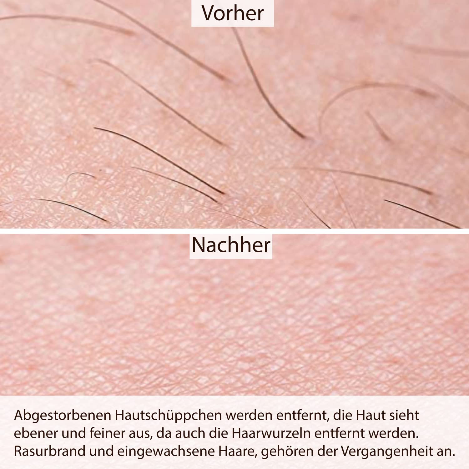 Beauty Sugar Kennenlern Set + 100 Vliesstreifen GRATIS - Zuckerpaste zur Haarentfernung - Alle drei Pasten á 500g - Kennenlernset Sugaring für Intimbereich, Gesicht und Körper