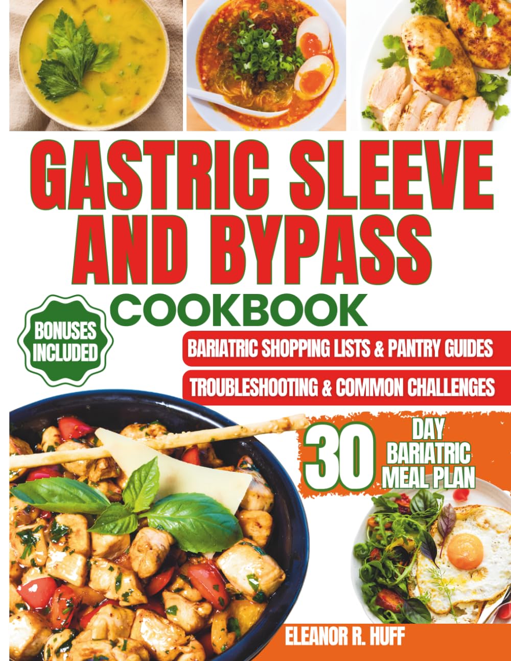 Gastric Sleeve and Bypass Cookbook: Effortless Bariatric Meal Prep Featuring High-Protein Recipes to Guide You Through Pre Op, Post Op, and Healthy Weightloss.