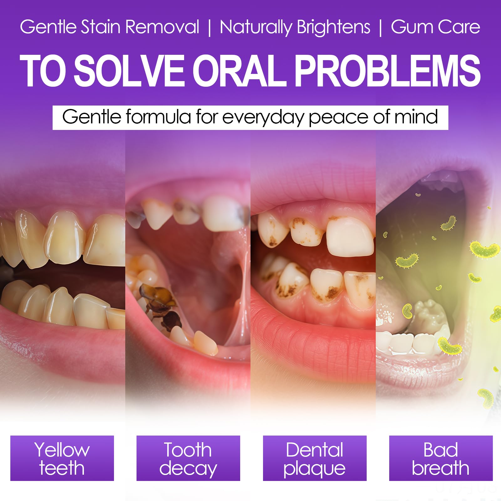 30ml Pasta de Dientes Púrpura Blanqueadora, Pasta Blanqueadora, Dientes Limpios y Brillantes, Proporciona un Blanqueamiento Suave y una Limpieza Eficaz, para una Sonrisa Más Blanca y Luminosa - 4