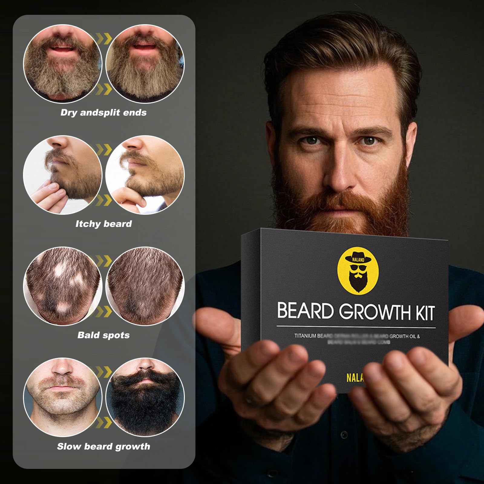 INVJOY Kit per la crescita della barba, Dermaroller con 540 aghi, olio di siero per la crescita della barba, balsamo da barba, regalo perfetto per gli uomini model 195