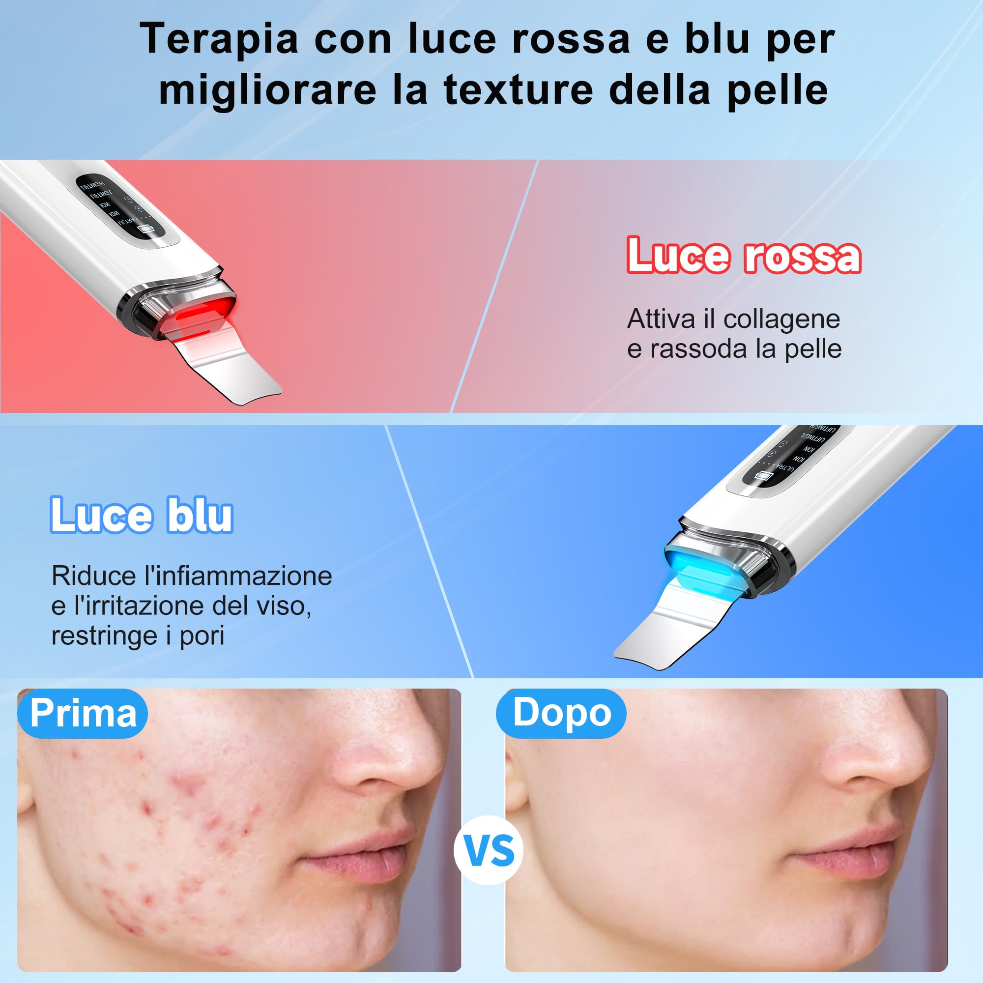 Pulizia Viso Ultrasuoni, Skin Scrubber con 4 Modalità e Impermeabile IPX7, Luce Rossa e Blu Spatola Professionale Punti Neri Rimozione Pulizia Profonda la Viso Peeling e Cura