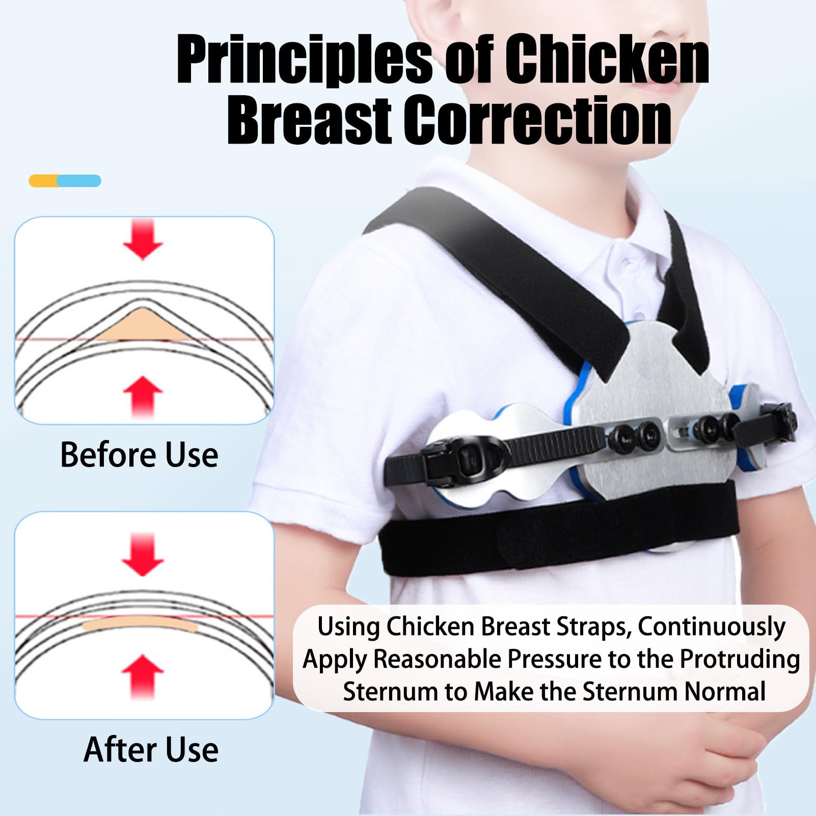 Pectus Carinatum Brace For Kids, Ribs Valgus Orthosis Braces, Soporte Pectoral Ajustable para Pecho De Paloma, Dispositivo OrtopéDico para Uso Diario