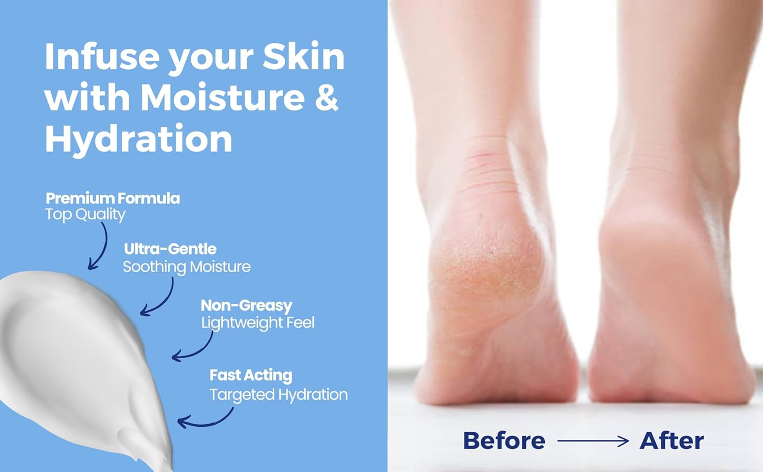 UREBALM25 500mL Ultra Moisturising Cream with 25% Urea For Cracked, Dry or Rough Skin UREA BALM