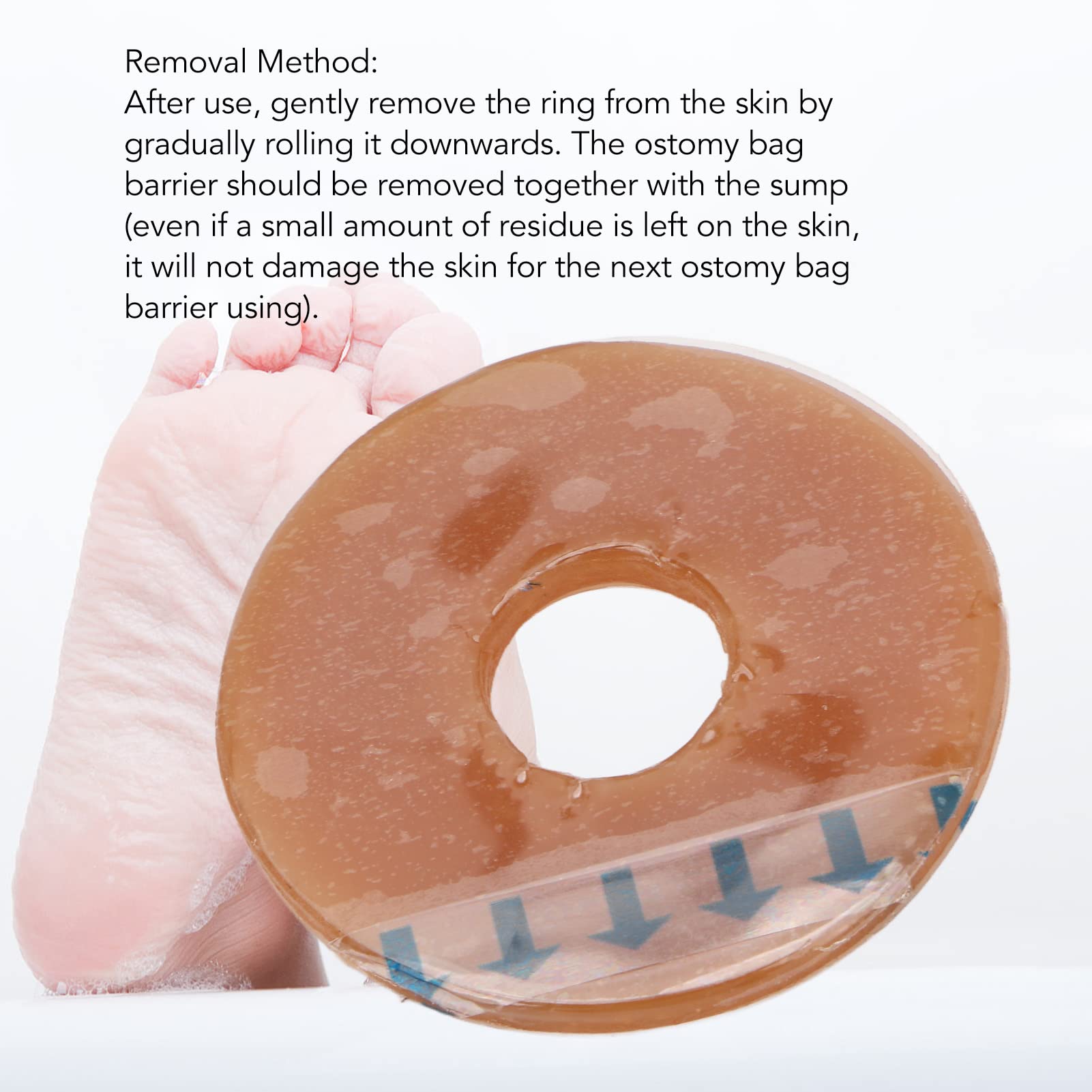10 Stück Ostomie-Barriere-Ringe, Ostomie-Tasche, Hautbarriere, Silikon, formbar, auslaufsicher, Hautschutz, Kolostomie-Tasche, Hautbarriere
