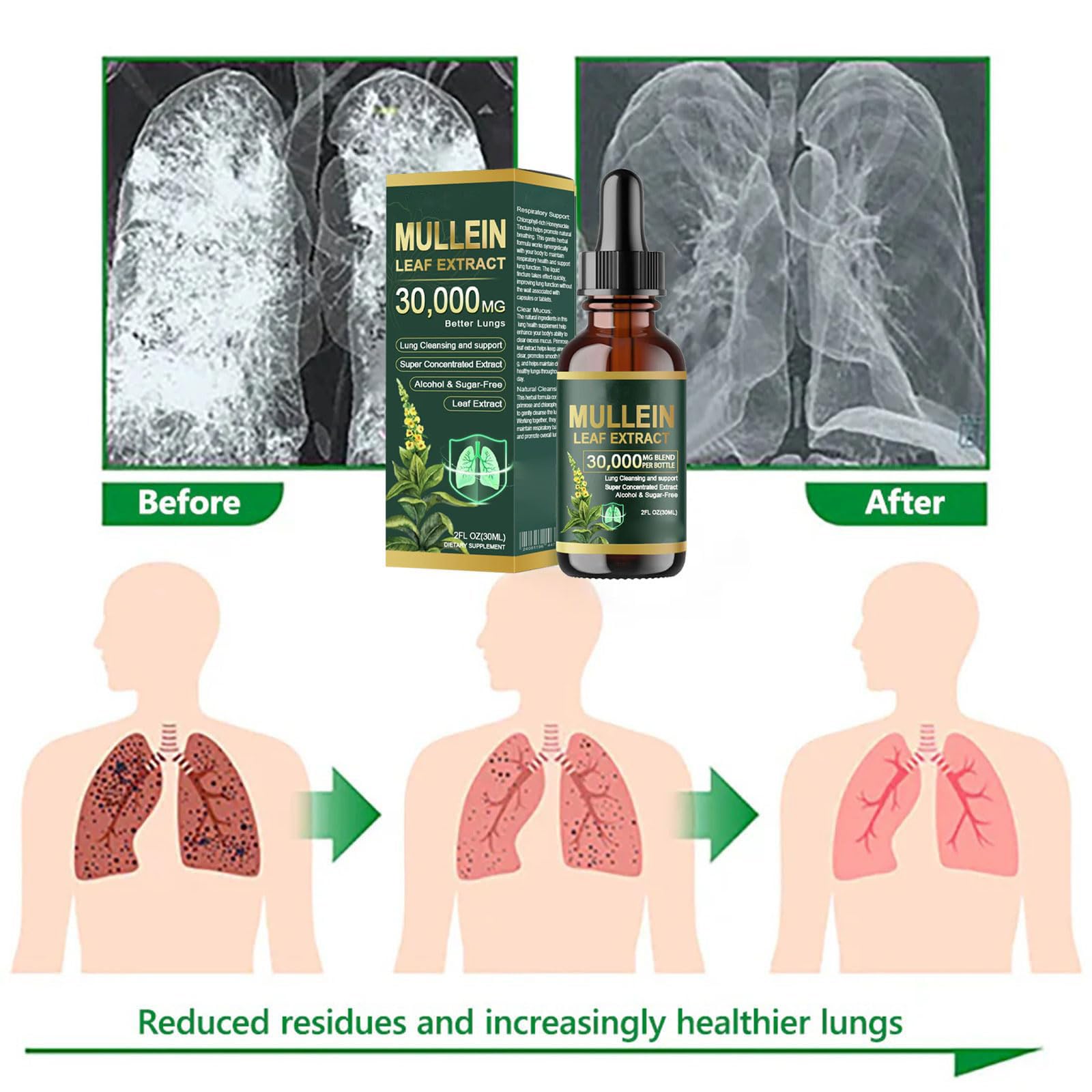 Gotas orgánicas de extracto de hoja de gordolobo para limpieza de pulmón, gotas de gordolobo para pulmones, extracto de hoja de gordolobo para pulmones, limpieza y apoyo respiratorio, fórmula natural